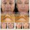 Portable high frequency machine for home use radio frequency facial machine