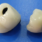 Dental Crown Multilayer Zirconia, Dental Teeth, Laboratoire Dentaire,Dentallabor, Laboratorio Dental