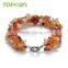 Topearl Jewelry Fashion Round Red Agate Bracelets White Pearls Women Bracelets 8 Inch BJ447373