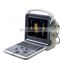 HC-A011 newest portable 4D color doppler ultrasound system