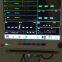 Patient Monitor with 12.1 Inch TFT Color Screen Benepm-12