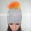 Myfur Light Grey Women Knit Hat with Real Fur Pom Pom Top