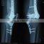 Instant Dental X-ray Film Reader Fuji Medical Laser X-ray Film
