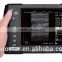 V5 Palm Ultrasound Scanner(ultrasonic,black white,Imaging Sys