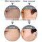 4 In 1 Oxygen Jet Face Lift Peeling Skin Rejuvenation Multifunction Machine CE Dispel Black Rim