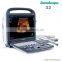 Sonoscape Portable Digital ultrasound machine color doppler