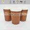 TOP 1 dentist paper cups compostable paper cup with great price