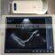 Excellent Portable Wireless Ultrasonic Transducer Probe for sale -WBU01