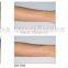 portable Best 808nm Diode Laser Body Hair Removal laser diode beauty equipment JB-808