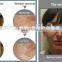 PDT led phototherapy/ photon light therapy machine