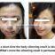 PDT/led Light Therapy Beauty Machine Red Led Light Therapy Skin For Skin Care Acne Removal