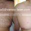2015 diode laser Type and Portable Style for depilation