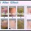 Anybeauty machine F7+ vaginal tightening device