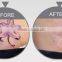 1 HZ 1064nm/532nm/650nm/585nm Q Switch Nd:yag 7 Jointed Vascular Tumours Treatment Arm Laser Tatoo Removal Beauty Machine