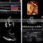 2016 Laptop/Portable 3D 4D ultrasound machine color doppler Diagnostic System