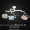 SY-I034 Wall type led Shadowless Operating Lamp surgical