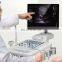 MY-A028G 2020 hot selling medical instrument 128 element cheap trolley ultrasound scan machine doppler