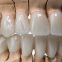 Smooth Surface Biocompatible Zirconia Tooth Crown Easy Maintain
