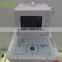 Portable hospital clinical ultrasound machine- BPU01