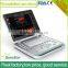 Sonostar 2016 Portable Digital Ultrasound Price Ultrasound Machine for Pregnancy C5