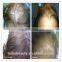 Distributor wanted 100% guaranteed hair regrow diode laser with laser comb