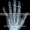 in the Nsecond of 2015 Standard Medicalfilm Dry Thermal X-ray Film the Most Popular China Supplier