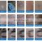 Excimer laser xecl 308nm portable targeted phototherapy psoriasis vitiligo laser machine