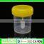 Colorful Sterile Specimen Container,disposable 60ml Stool Container Specimen Container