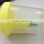 green color A5 luer adapter needle set of urine container
