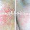 Medical Diode 980nm Laser for Vascular Removal Beauty Machine Device