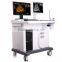 MCB-18T Trolley Ultrasound Scanner with Workstation