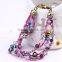 2016 Pretty Women Bangle New Models Bracelets