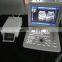 best price  scanner  handheld medical portable laptop black and white ultrasound