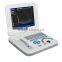 Health & Medical Equipment Ultrasonic Diagnostic Scanner Portable Ultrasound Scanner