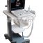 Medical Equipment Ultrasound System Portable Ultrasound Machine Scanner