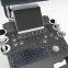 4D Color Doppler Ultrasound Scanner with Touch Screen