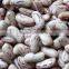 light speckled kidney beans