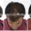 New products 2016 5 panels diode laser hair growth