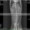 MY-W004B Vet x Ray Machine Analogue or Digital Radiography System Veterinary Medical X-ray Equipments