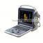 2016 beautiful 3d/4d ultrasound color doppler scanner with fetus