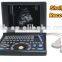 Good Image Portable/Notebook/Laptop RUS-9000E2 ultrasound Scanner/machine with convex probe, linear, vaginal, rectal transducer