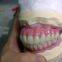 CAM Milled Titanium Bar Dental Implant Hybrid Prosthesis Dentures Metal Implant Bar
