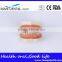 Dental Moderate Periodontal Disease Model Teaching Demonstration