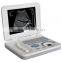 medical laptop sleek ultrasound scan machine cheapest ultrasound for vet