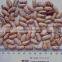 China New Crop Good Quality Light Speckled Pinto Kidney Bean