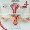 Pathology uterus model