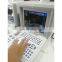 HC-A001 Happycare Full digital Portable 10 inch laptop ultrasound machine scanner Cheapest cheap ultrasound machine device