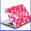 New design pattern hard plastic case for Macbook hard case