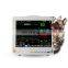 Home Use and Hospital Clinic Veterinary Multiparameter Monitor Veterinary Monitor
