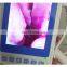 HC-G027E Medical home health care 3.9mm Otoscope 66C Video inspection device Visual ENT endoscope Camera Video otoscope